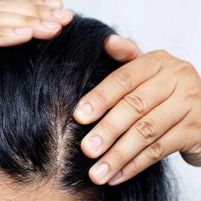 Scalp Care